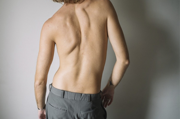 【型男Care】脊椎側彎可以重訓嗎？一窺改善方法及運動治療