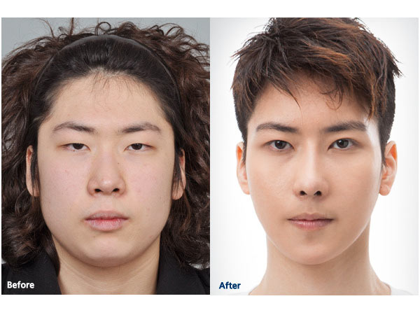 韓國整型節目《LET美人》首位人工美男「朴振培」，從體重破百垂奶胖男變身韓流偶像！